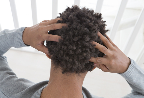 natural hair with itchy scalp